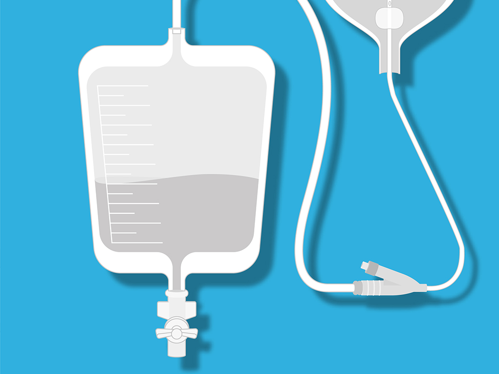 Sets sondage urinaire (vésicale) + urologie autres