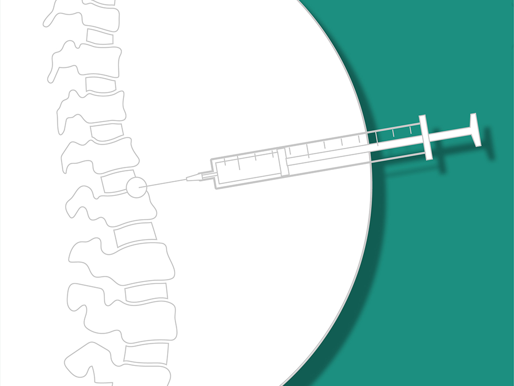 Sets anésthésiologie